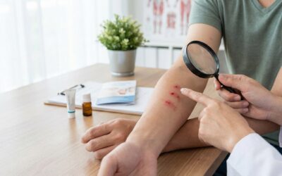 Bedwantsen blog 6 Bedwantsenbeten op dezelfde plaats: gids en oplossingen